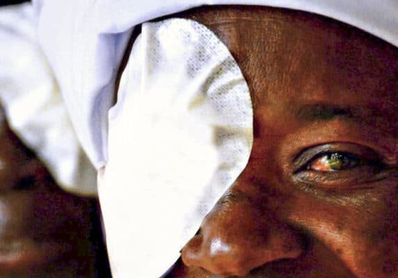 Woman in Kenya waiting to have eye patch removed after surgery by The Fred Hollows Foundation